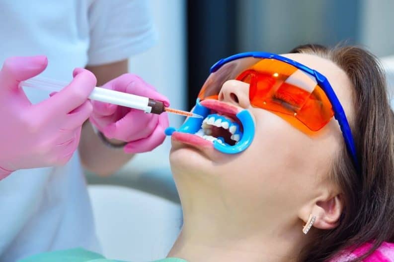 Get a brighter smile in minutes with instant results whitening Burton upon Trent