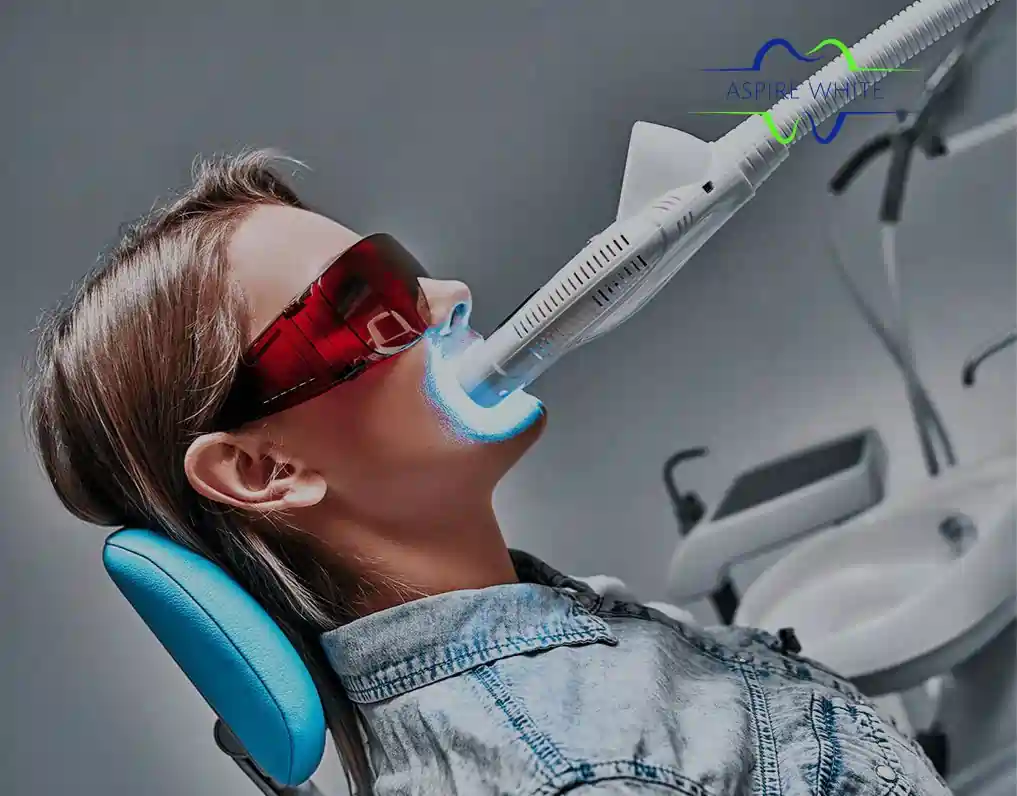 1 Hour Teeth Whitening with Aspire White Burton upon Trent
