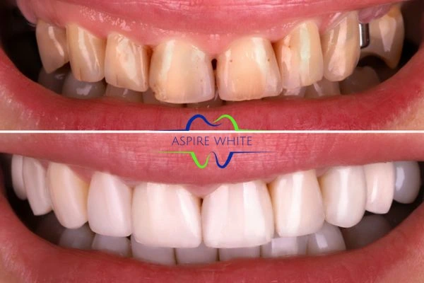 Before And After Results Burton upon Trent