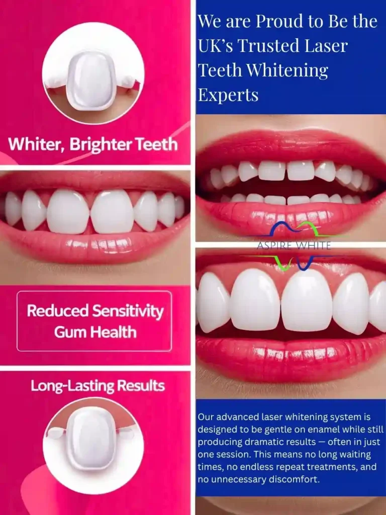 We are Proud to Be the UK’s Trusted Laser Teeth Whitening Experts Burton upon Trent