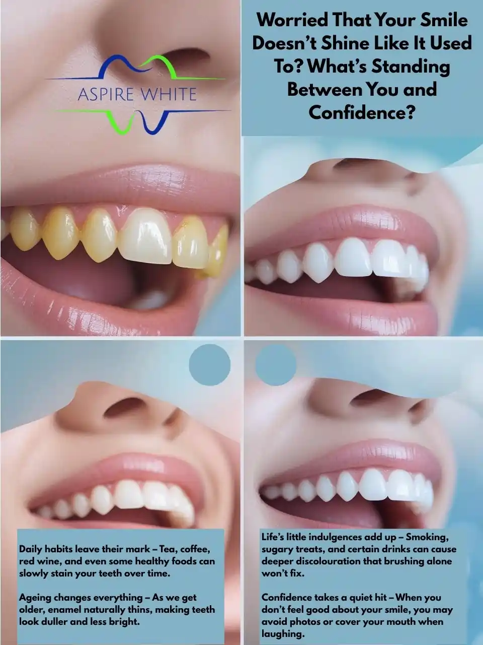 Worried That Your Smile Doesn’t Shine Like It Used To What’s Standing Between You and Confidence Burton upon Trent